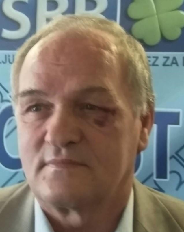 Fizički napadnut federalni poslanik SBB-a Zijad Alajbegović