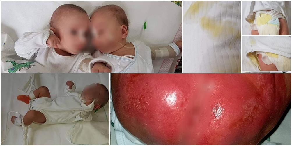 Objavljene slike iz zagrebačke bolnice: Bebe leže u mokraći, vezane za krevet