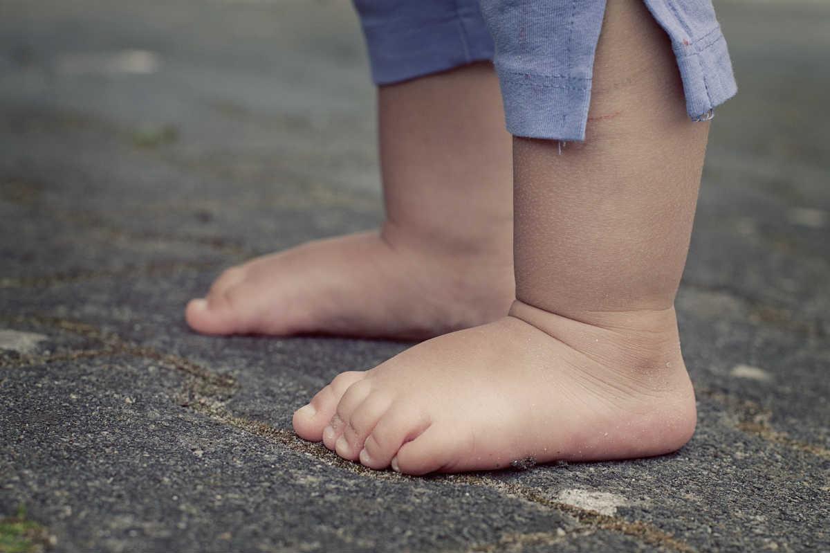 Najčešće je riječ o fleksibilnom ravnom stopalu, koje se s godinama namiješta u pravilan položaj - Avaz