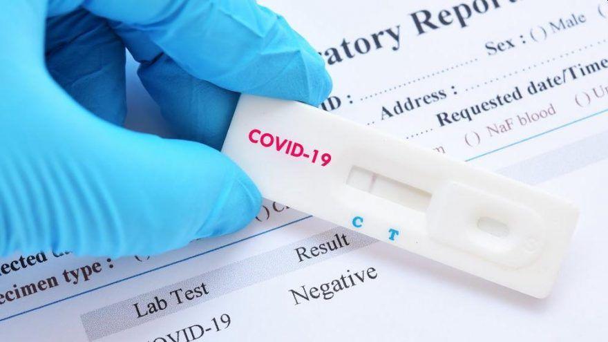 Srbija će do jeseni imati svoj test na koronavirus