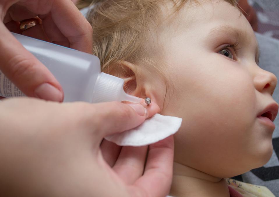 Može nastati i poseban oblik ožiljka koji se naziva keloid - Avaz