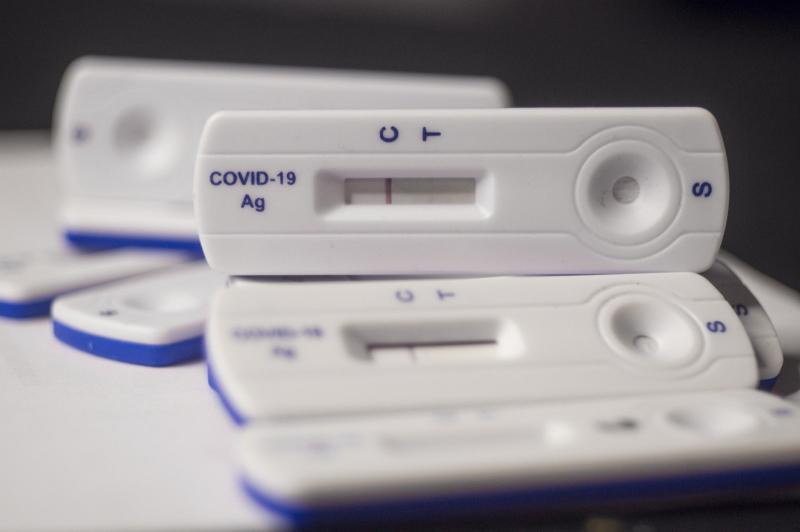 PCR testovi - Avaz