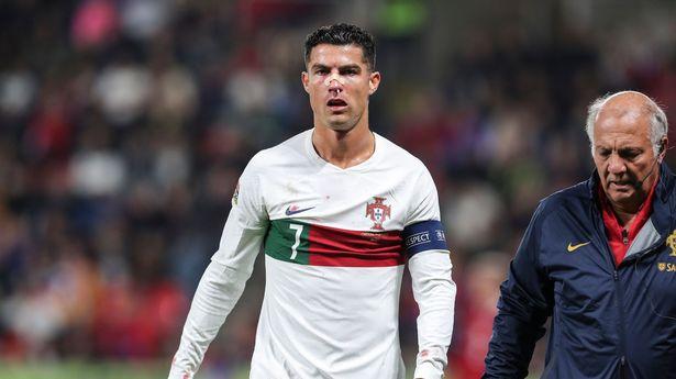 Pogledajte kako je nakon nokauta u Pragu izgledao Ronaldo