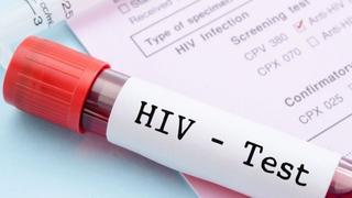 Spolno prenosive bolesti: Razlika između HIV-a i AIDS-a