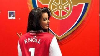 Arsenal ugostio Ivanu Knoll na utakmici protiv Mančester sitija