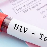 Spolno prenosive bolesti: Razlika između HIV-a i AIDS-a